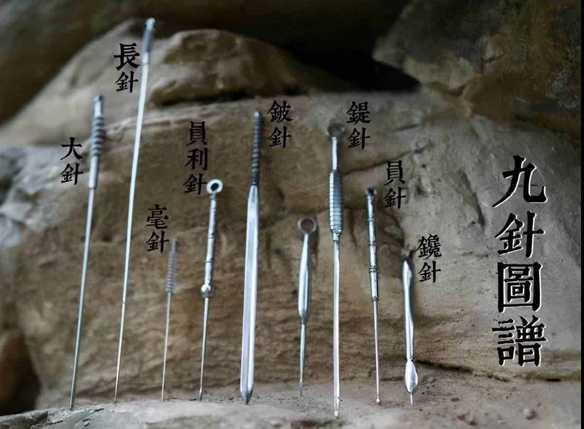 古代针灸用具是什么针，古代针灸用具多少针