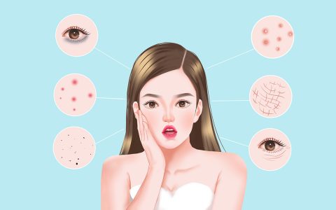 长期长痘为何因?内调比外敷重要