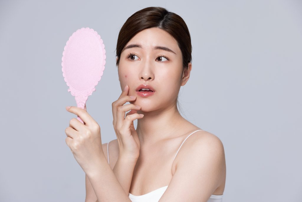长期长痘为何因？内调比外敷重要